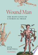 Wound Man : The Many Lives Of A Surgical Image