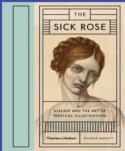The Sick Rose : Or; Disease and the Art of Medical Illustration
